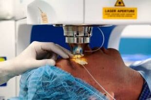 Operazione di visione laser